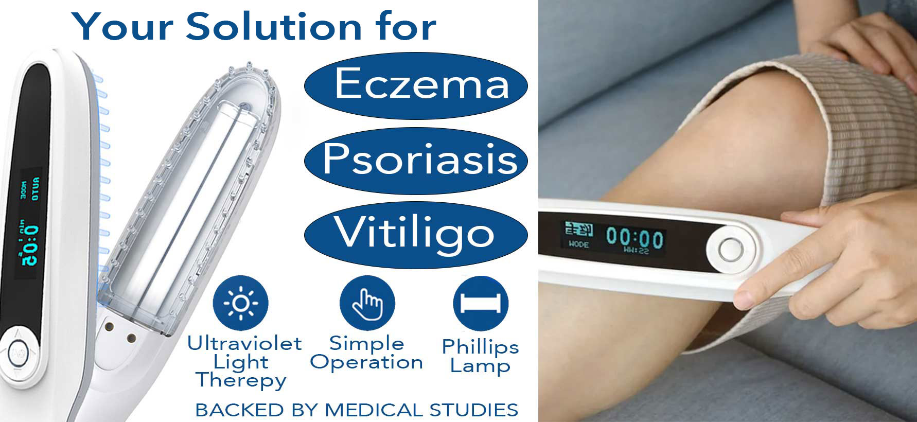 Help Treat Cure Eczema Psoriasis in South Africa